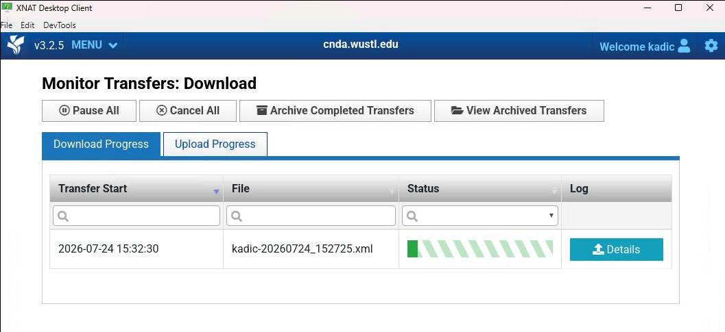 watch download progress