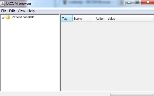 dicom browser