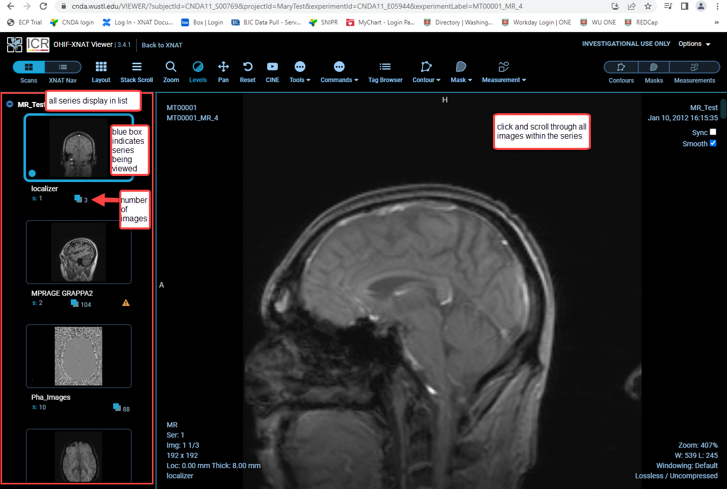 OHIF viewer